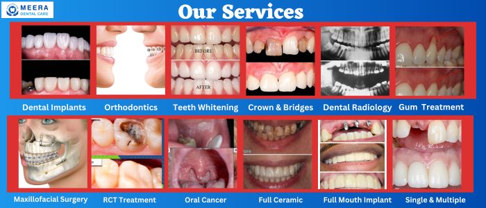 Best-Dental-Care-Services-in-Ajmer