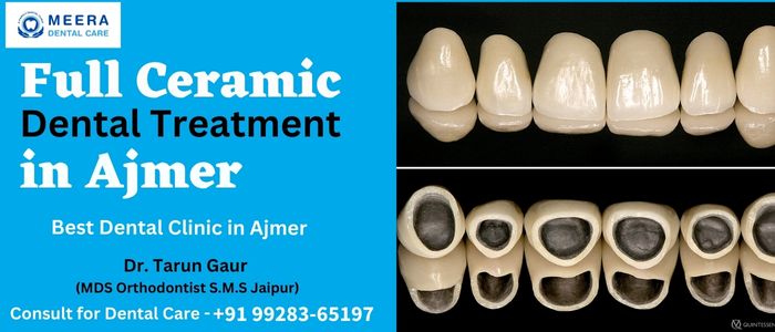 Full Ceramic tooth dental treatment in Ajmer