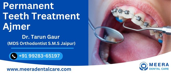 Permanent Teeth Treatment in Ajmer