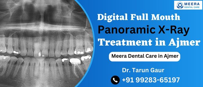 Digital Full Mouth Panoramic X-Ray in Ajmer