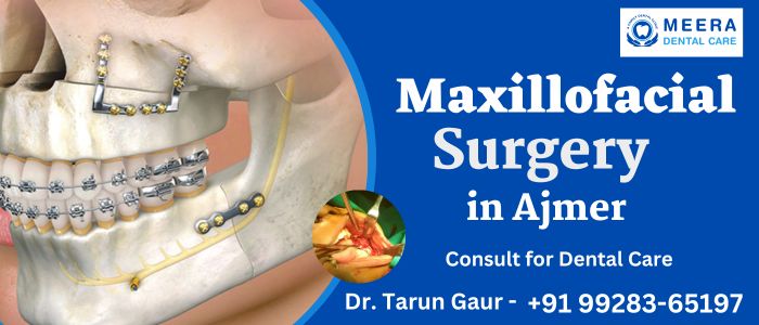 Maxillofacial Surgery Treatment in Ajmer