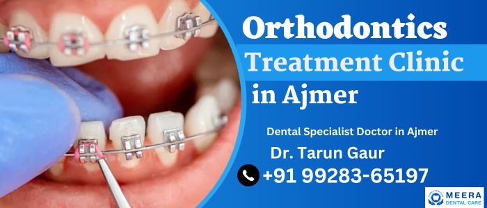 Orthodontics Treatment Services in Ajmer